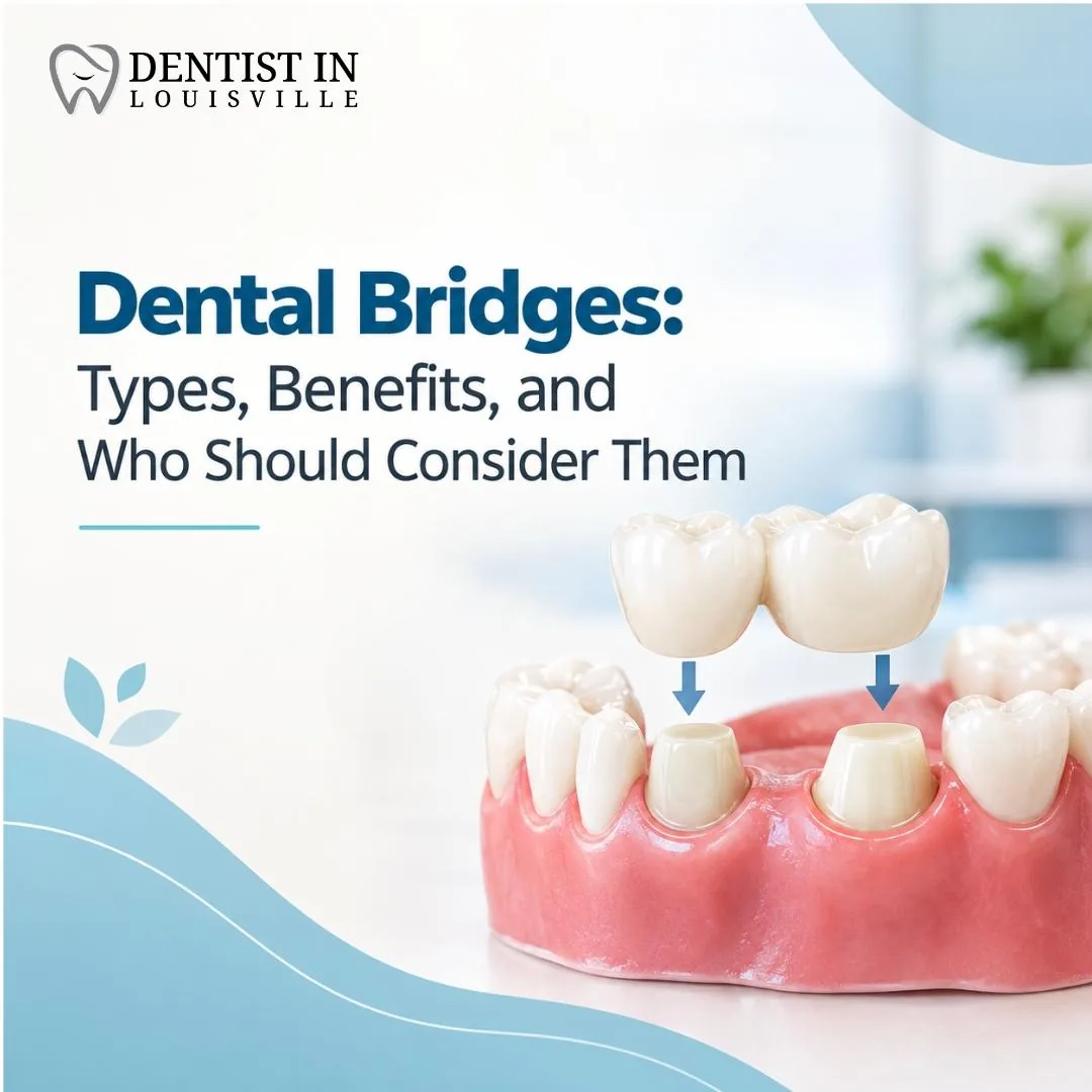 Dental Bridges: Types, Benefits, and Who Should Consider Them