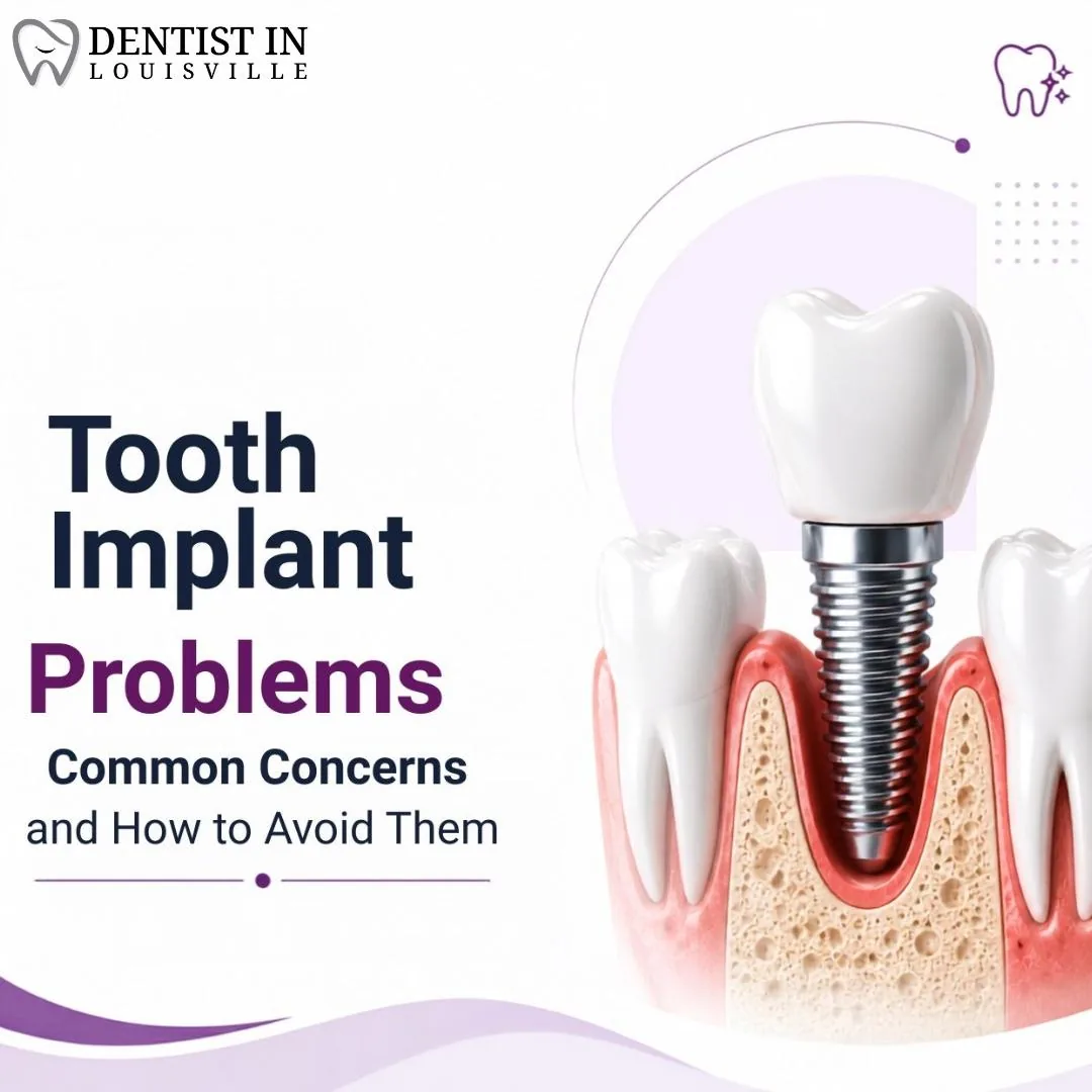 The Ultimate Guide to Dental Implant Success: Overcoming Common Challenges