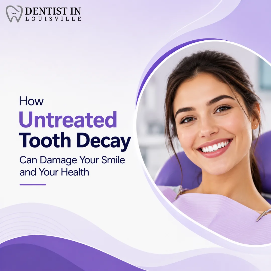 How Untreated Tooth Decay Can Damage Your Smile and Your Health