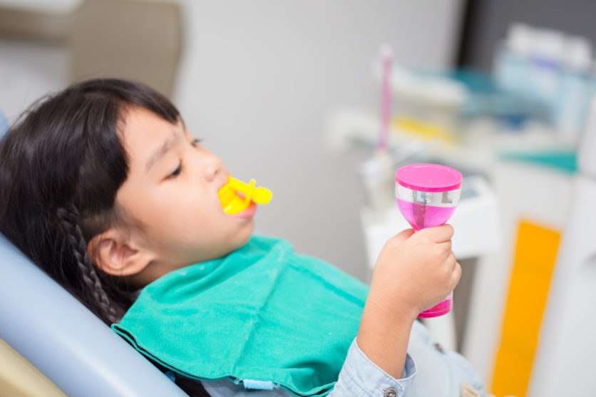 Fluoride Trays