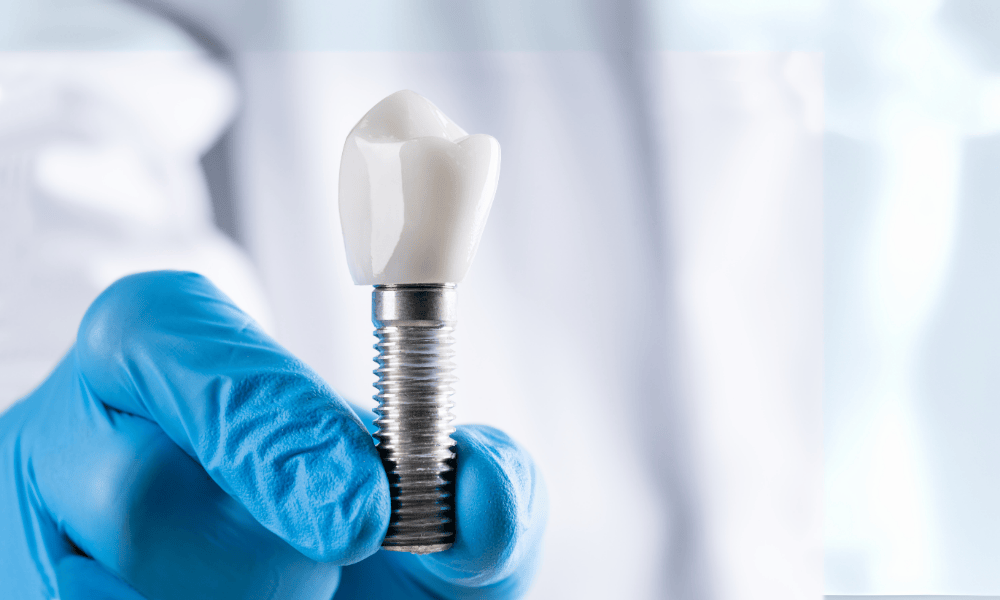 Why Choose Dentist in Louisville for Dental Implants?